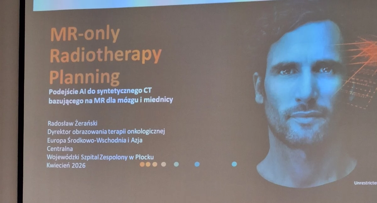 Zdrowie, Wojewódzki Szpital Zespolony Płocku wkracza diagnostyki onkologicznej - zdjęcie, fotografia