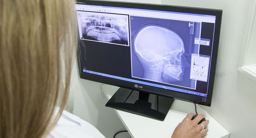 Dobre wieści dla płockiego szpitala. Są pieniądze na nowy sprzęt 